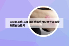 三亚银屑病 三亚银屑病医院搜公众号名医堂良媒自助挂号
