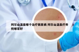 阿尔山温泉哪个治疗银屑病 阿尔山温泉疗养院哪家好