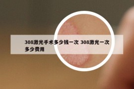308激光手术多少钱一次 308激光一次多少费用