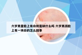 六岁男童脸上有白斑是缺什么吗 六岁男孩脸上有一块白的怎么回事