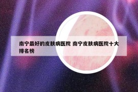 南宁最好的皮肤病医院 南宁皮肤病医院十大排名榜