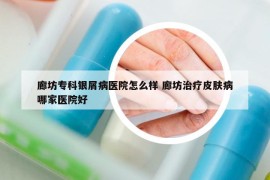 廊坊专科银屑病医院怎么样 廊坊治疗皮肤病哪家医院好