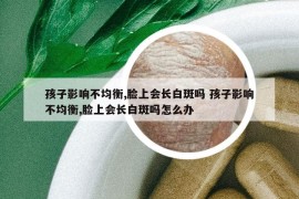 孩子影响不均衡,脸上会长白斑吗 孩子影响不均衡,脸上会长白斑吗怎么办