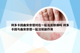 利多卡因曲安奈德对在一起治皮肤病吗 利多卡因与曲安奈德一起注射副作用