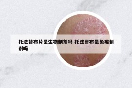 托法替布片是生物制剂吗 托法替布是免疫制剂吗