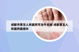 成都市第五人民医院可治牛皮癣 成都第五人民医院最擅长