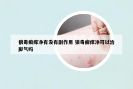 狼毒癣痒净有没有副作用 狼毒癣痒净可以治脚气吗
