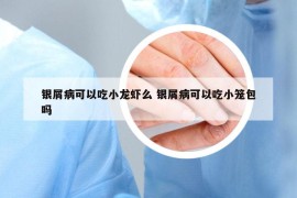 银屑病可以吃小龙虾么 银屑病可以吃小笼包吗