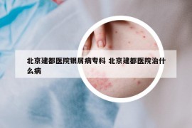 北京建都医院银屑病专科 北京建都医院治什么病