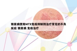银屑病使用MTX免疫抑制剂治疗常见的不良反应 银屑病 免疫治疗