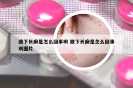 腋下长癣是怎么回事啊 腋下长癣是怎么回事啊图片