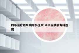 四平治疗银屑病专科医院 四平皮肤病专科医院