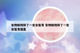 生物制剂停了一定会复发 生物制剂停了一定会复发强直