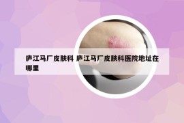 庐江马厂皮肤科 庐江马厂皮肤科医院地址在哪里