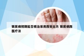 银屑病初期能否根治采用西安北方 银屑病西医疗法
