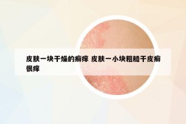 皮肤一块干燥的癣痒 皮肤一小块粗糙干皮癣很痒