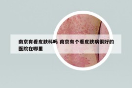 南京有看皮肤科吗 南京有个看皮肤病很好的医院在哪里