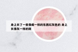 身上长了一些像癣一样的东西红灰色的 身上长像灰一样的斑