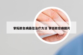 掌拓脓包病最佳治疗方法 掌括脓包病图片