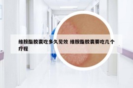 维胺酯胶囊吃多久见效 维胺酯胶囊要吃几个疗程