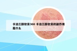 卡泊三醇软膏360 卡泊三醇软膏的副作用是什么