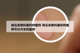 商丘皮肤科最好的医院 商丘皮肤科最好的医院可以冷冻的医院