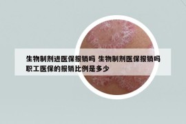 生物制剂进医保报销吗 生物制剂医保报销吗职工医保的报销比例是多少