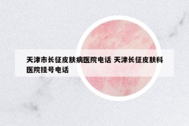 天津市长征皮肤病医院电话 天津长征皮肤科医院挂号电话