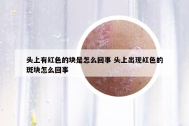 头上有红色的块是怎么回事 头上出现红色的斑块怎么回事