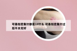 可善挺密集针都是10针么 可善挺密集针过后不太见好