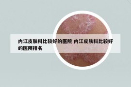内江皮肤科比较好的医院 内江皮肤科比较好的医院排名