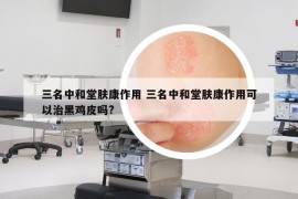 三名中和堂肤康作用 三名中和堂肤康作用可以治黑鸡皮吗?