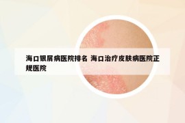 海口银屑病医院排名 海口治疗皮肤病医院正规医院