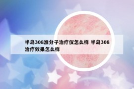 半岛308准分子治疗仪怎么样 半岛308治疗效果怎么样