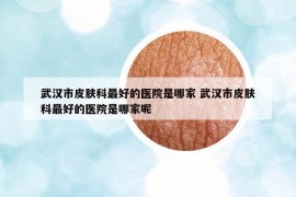 武汉市皮肤科最好的医院是哪家 武汉市皮肤科最好的医院是哪家呢