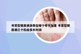 寻常型银屑病多数在哪个季节加重 寻常型银屑病三个阶段多长时间