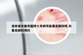 吉林省长春市医院十月四号能看皮肤科吗 长春皮肤科预约
