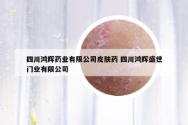 四川鸿辉药业有限公司皮肤药 四川鸿辉盛世门业有限公司