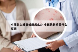 小孩头上反复长癣怎么办 小孩头长癣是什么原因