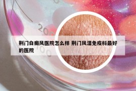 荆门白癜风医院怎么样 荆门风湿免疫科最好的医院
