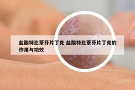 盐酸特比萘芬片丁克 盐酸特比萘芬片丁克的作用与功效