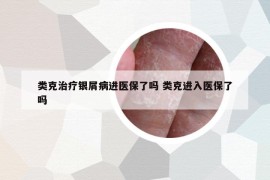 类克治疗银屑病进医保了吗 类克进入医保了吗