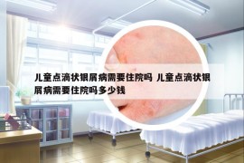 儿童点滴状银屑病需要住院吗 儿童点滴状银屑病需要住院吗多少钱