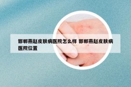 邯郸燕赵皮肤病医院怎么样 邯郸燕赵皮肤病医院位置