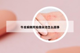 牛皮癣刚开始像水泡怎么回事