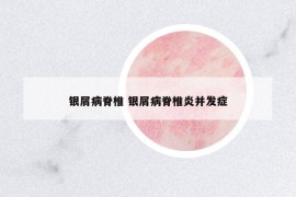 银屑病脊椎 银屑病脊椎炎并发症