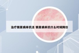治疗银屑病单抗法 银屑病单抗什么时候降价
