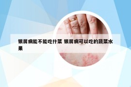 银屑病能不能吃什菜 银屑病可以吃的蔬菜水果