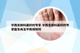 华西皮肤科最好的专家 华西皮肤科最好的专家医生冉玉平教授如何
