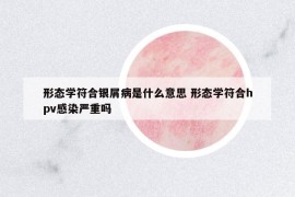 形态学符合银屑病是什么意思 形态学符合hpv感染严重吗